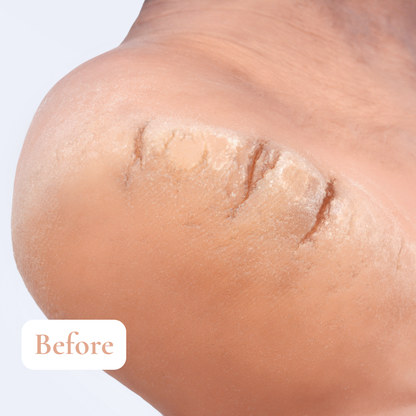 Même Cosmetics - L’onguent fissures et crevasses 30ml