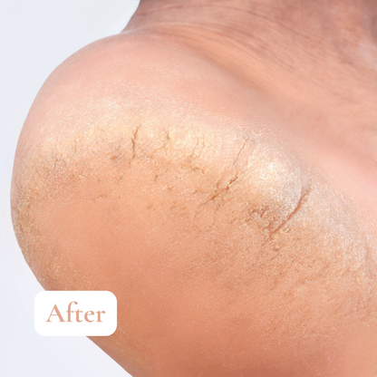 Même Cosmetics - L’onguent fissures et crevasses 30ml